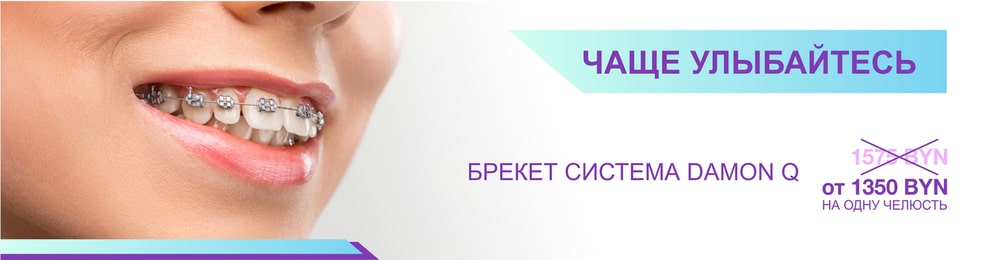 Самолигирующие брекеты (акция завершена) Самолигирующие брекеты (акция завершена)