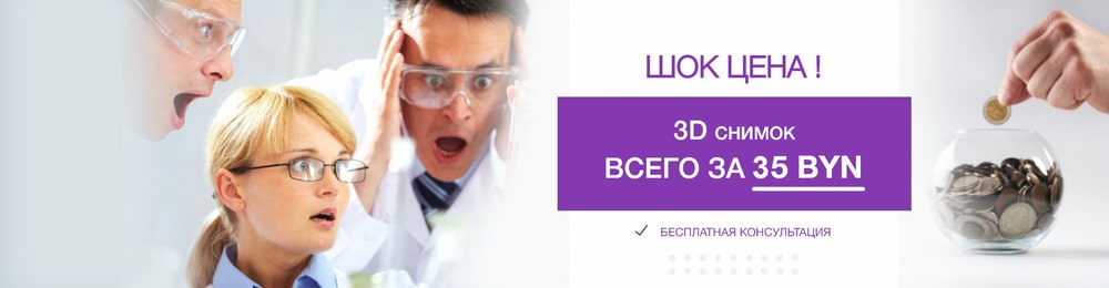Акция 3D-снимок