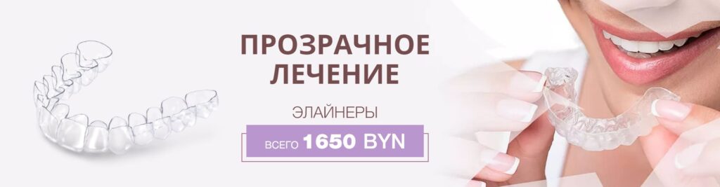 Скидка на элайнеры - фото Акция прозрачное лечение в стоматологии в Минске
