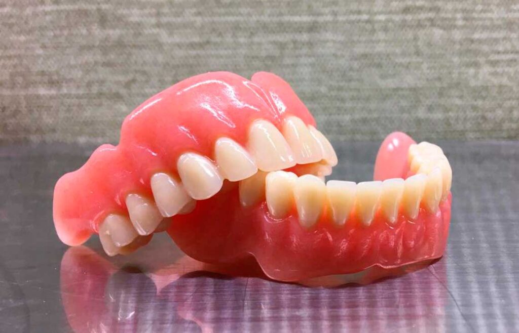 Съемный зубной протез
