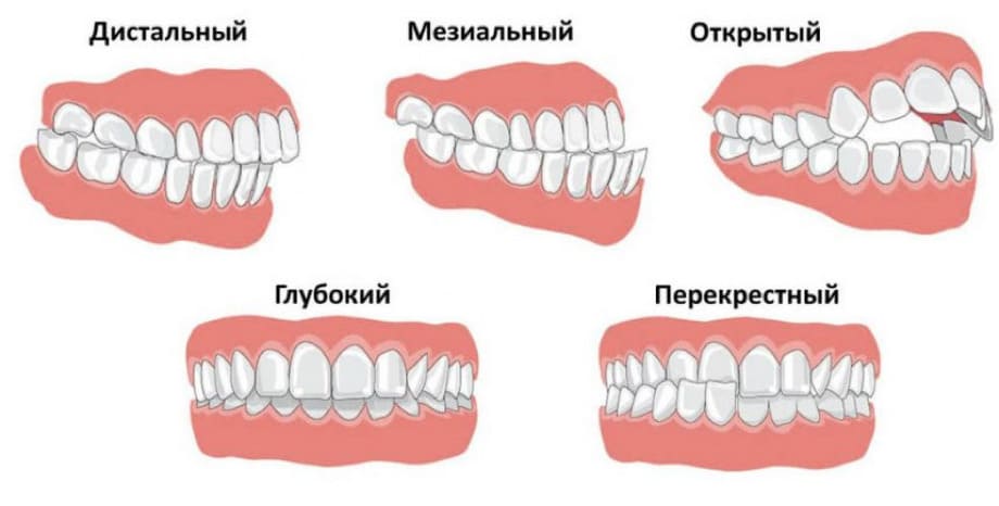 Выровнять прикус зубов Удаление зуба Томск Сухумская