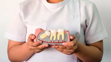 Стоит ли ставить вместо зубов мудрости имплант