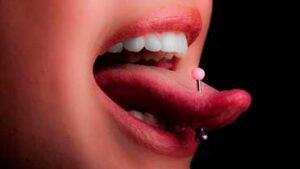 Вредит ли пирсинг на языке зубам?