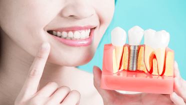 Имплантация зубов при пародонтите и пародонтозе