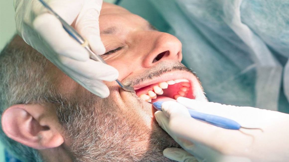 Осколок зуба после удаления