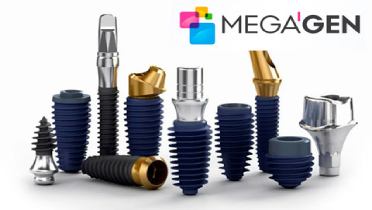 Преимущества зубных имплантов MegaGen перед другими брендами