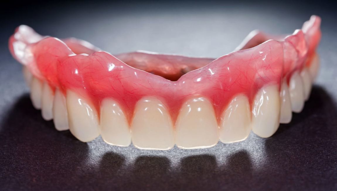 Отбеливание зубных протезов