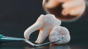 Анатомия человеческого зуба.