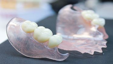 Особенности зубных протезов Акри Фри.