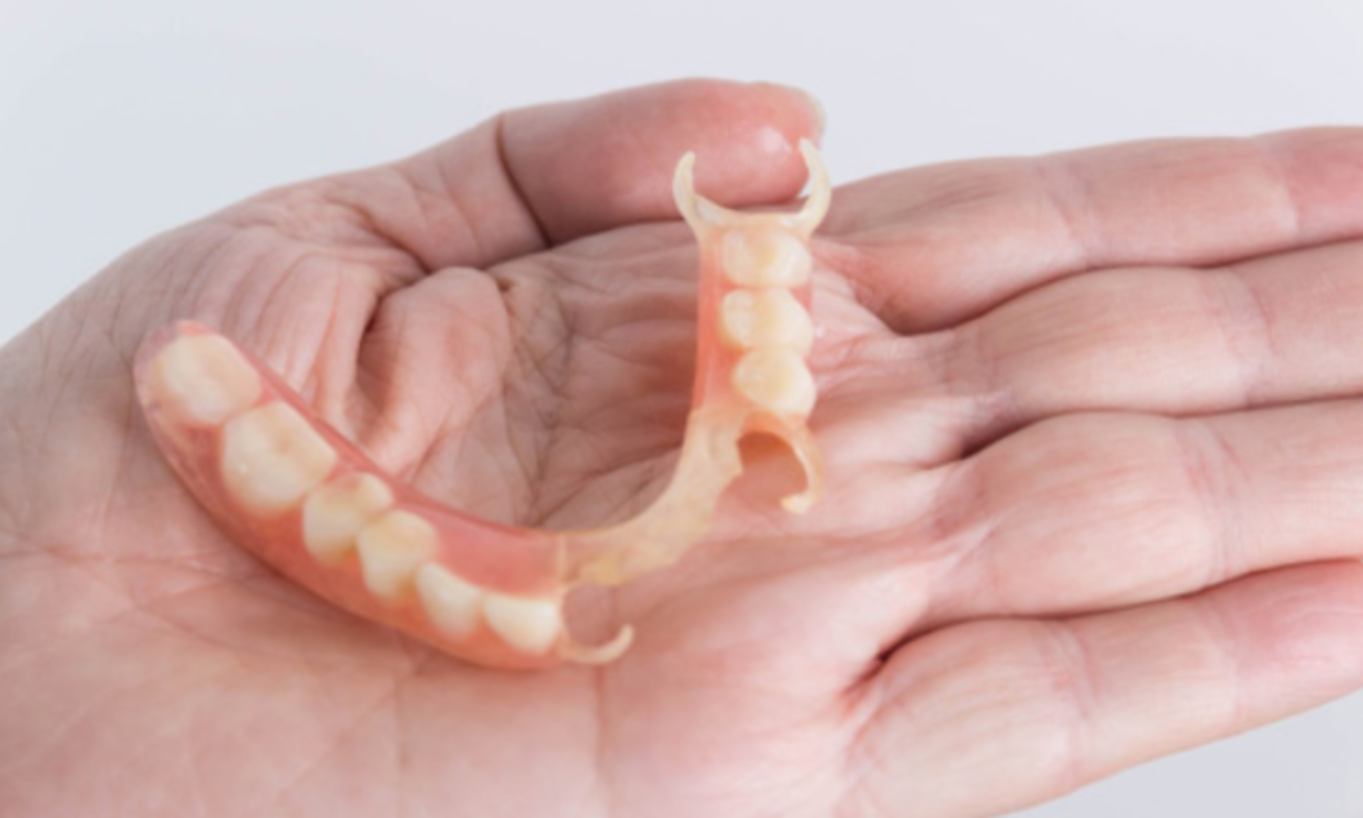 протез Бабочка