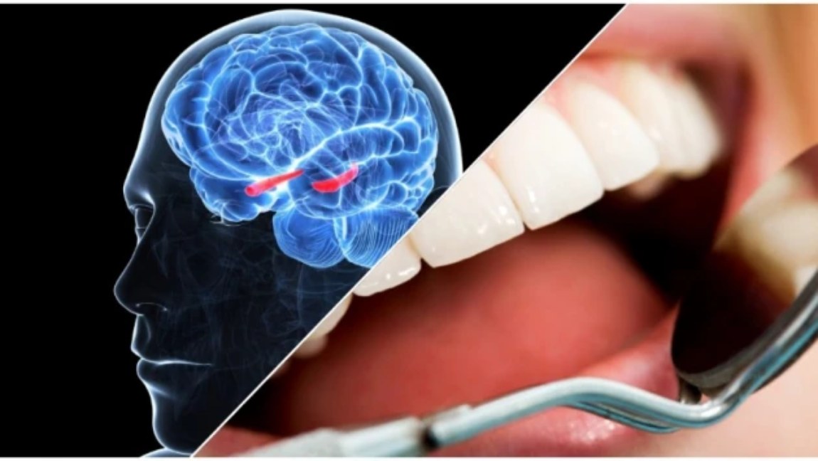 Взаимосвязь между зубами и мозгом