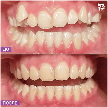 Пример работы зубной клиники