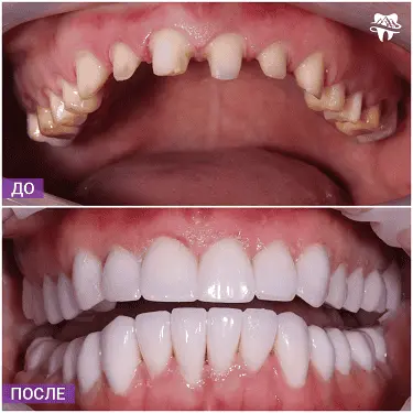 Пример работ стоматологии